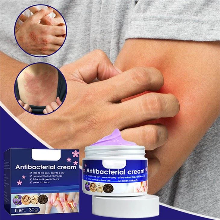 Skin Itching Cream