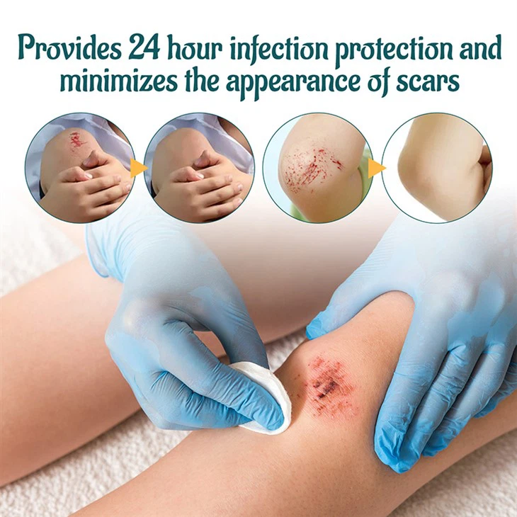 Wound Repair Scar Smoothing Ointment